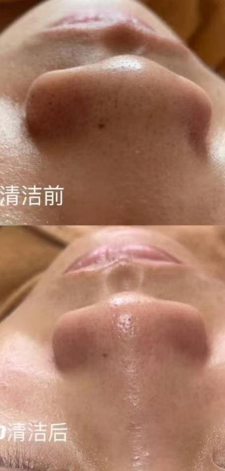 悦己美容肩颈腰腿疼痛舒缓