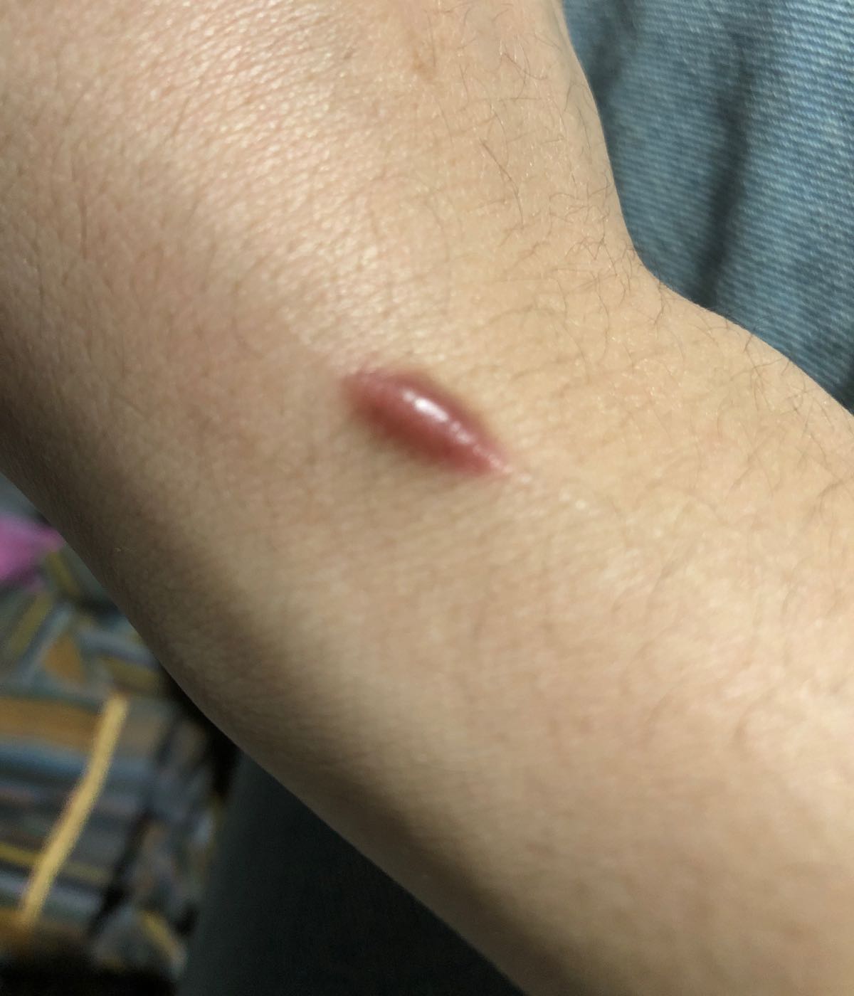 昆明昆大疤痕医学研究院