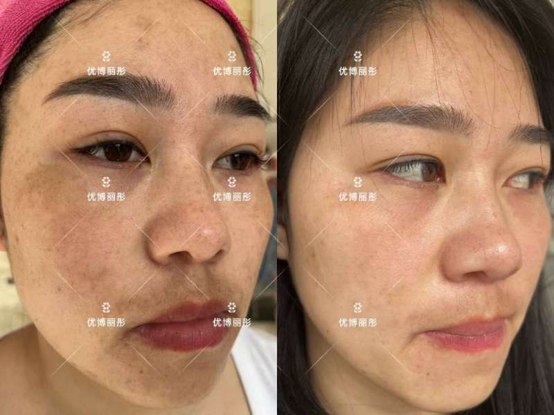 伊然美减肥美荣养生馆