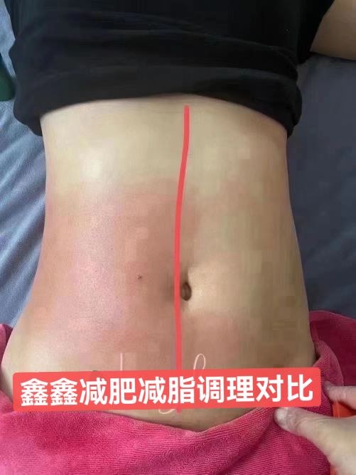 鑫鑫整骨推拿
