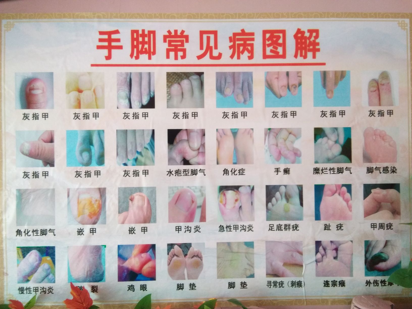清清修脚