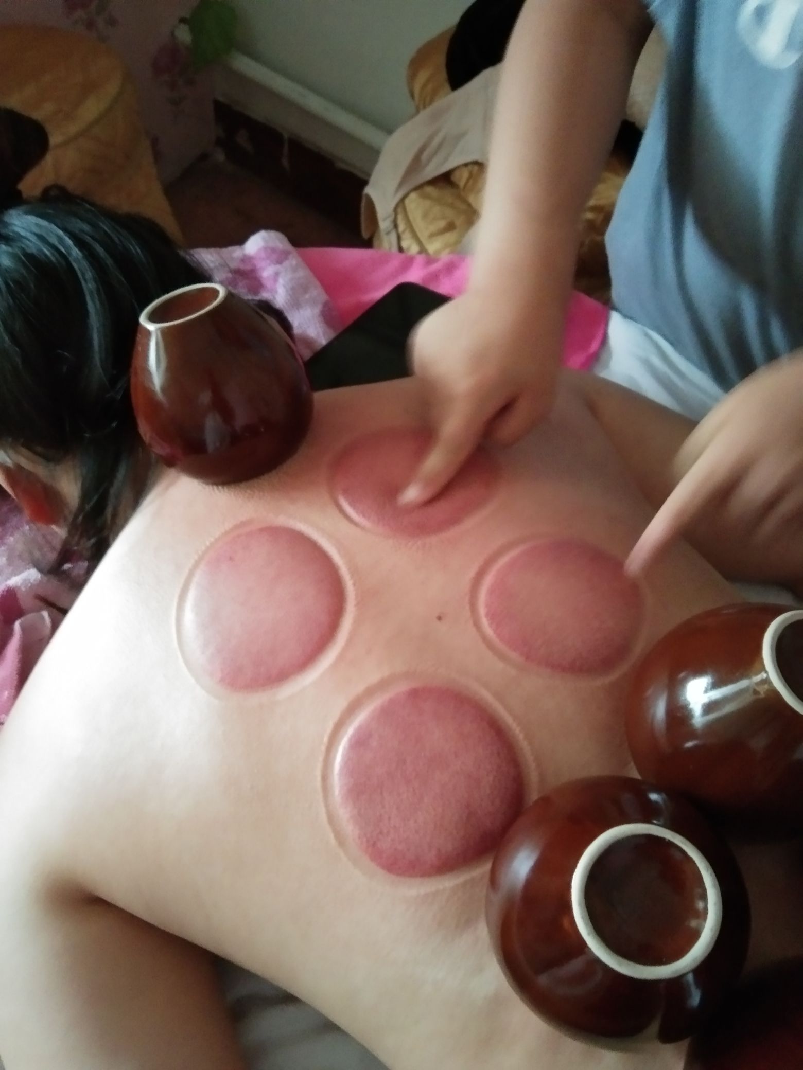 氏推拿按摩艾灸