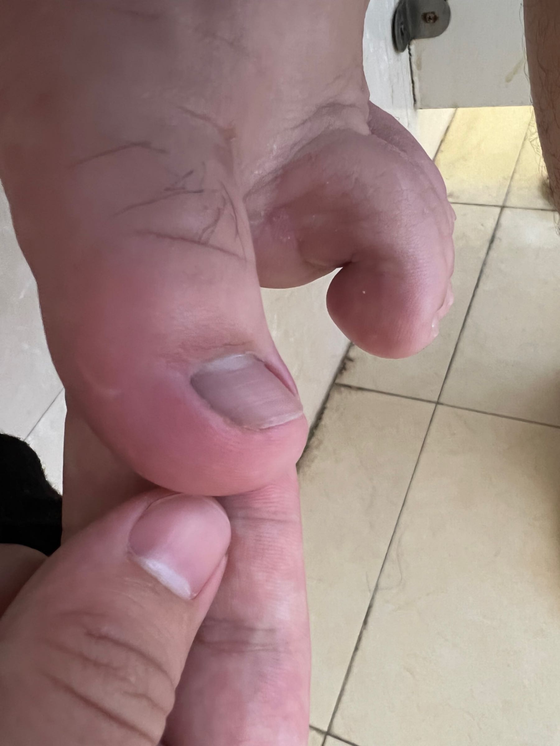 陕西紫阳专业修脚房(汽车东站店)