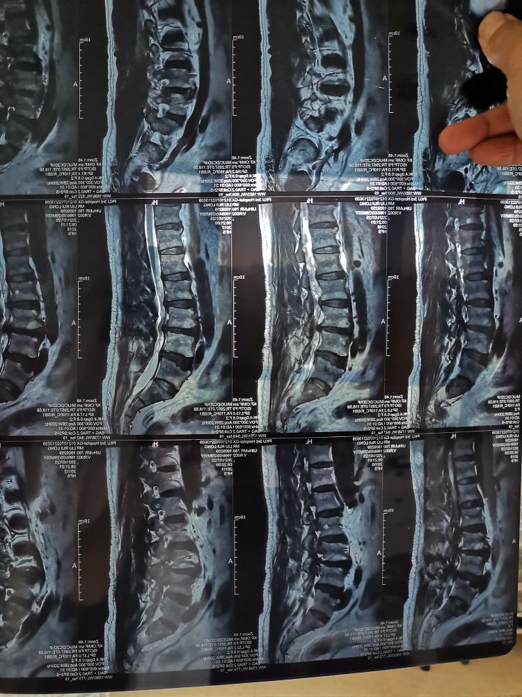 颈舒康按摩正骨艾灸