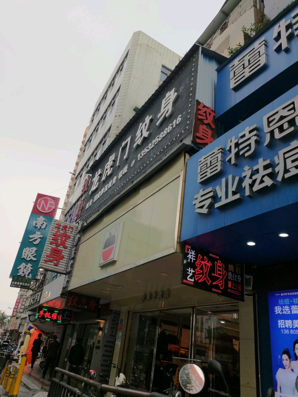 皮秒洗纹身