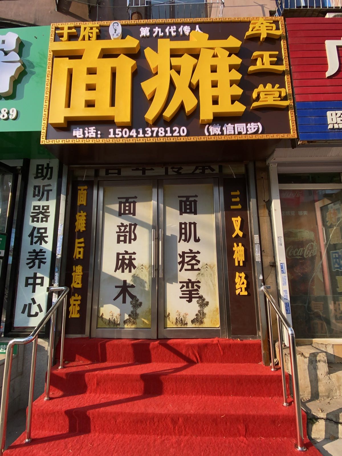 于府面瘫牵正堂