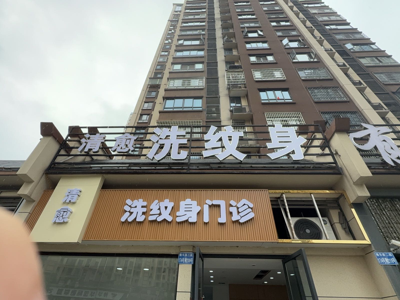洗纹身门诊