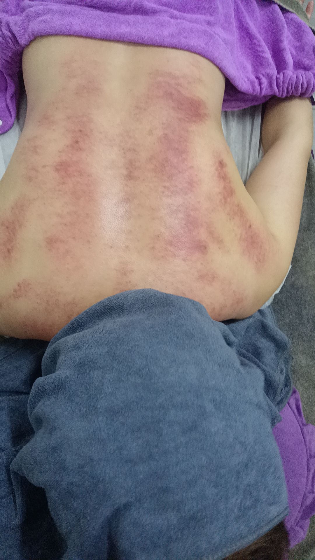 悦己美容肩颈腰腿疼痛舒缓
